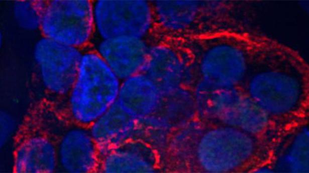 Scientists decipher how the coronavirus quickly damages lung cells